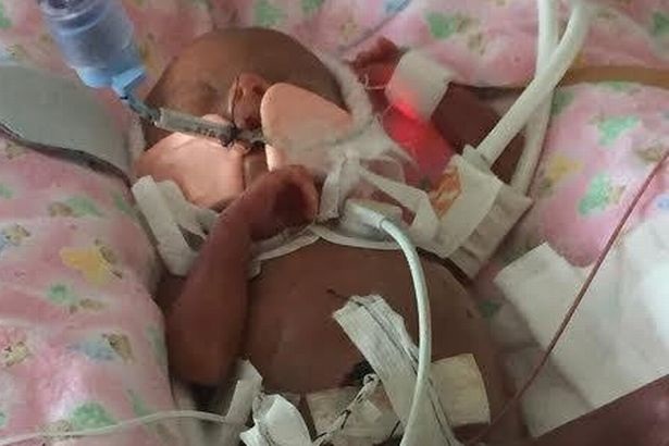 Nghị lực sống phi thường của em bé sinh non "bé hơn tờ 10 Bảng" - 5 Nghị lực sống phi thường của em bé sinh non "bé hơn tờ 10 Bảng" - 5