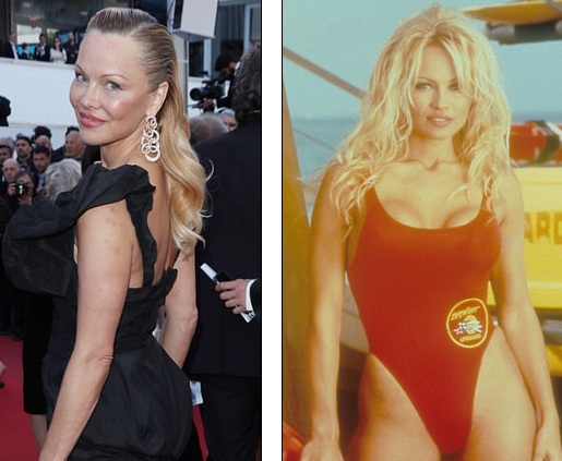 
Pamela Anderson - hiện tại (trái) và quá khứ (phải) có nhiều điểm khác biệt khiến cô bị đồn lạm dụng dao kéo thẩm mỹ
