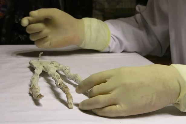 Bàn tay của người ngoài hành tinh có 3 ngón?