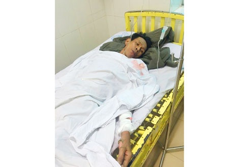 Đổ xăng thiêu chủ quán vì không cho nợ 30 nghìn - 1 Ông Hùng bị bỏng nặng, được cấp cứu tại bệnh viện Quân y 211