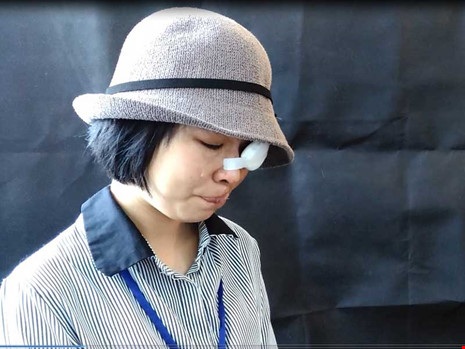 Nữ sinh bị tạt a xít: "Em từng rất tuyệt vọng" - 1 Thu Hương: “Em có thể chịu đau được nhưng còn ba mẹ em...”. Ảnh: NGUYỄN TRÀ