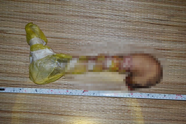 Phát hiện cẳng chân người trong túi nylon tại bãi rác lớn nhất Trà Vinh - 1 Đoạn cẳng chân phải được phát hiện tại bãi rác.