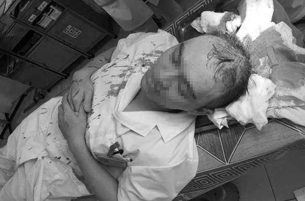 Hà Nội: Bác sĩ bị đánh bất tỉnh, theo dõi chấn thương sọ não - 1
Bác sĩ D. bị người nhà bệnh nhân đánh bất tỉnh (ảnh Vietnamnet)