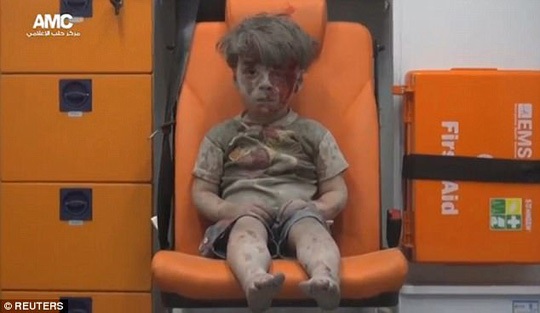Gặp lại cậu bé “biểu tượng chiến tranh Syria” - 1 Hình ảnh bé Omran hồi năm ngoái trở thành biểu tượng chiến tranh ở Syria. Ảnh: Reuters