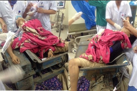 Nam thanh niên bị nghiền nát chân và mắc kẹt trong máy gạch - 1 Nam thanh niên được đưa tới bệnh viện trong tình trạng bị mắc kẹt trong chiếc máy.