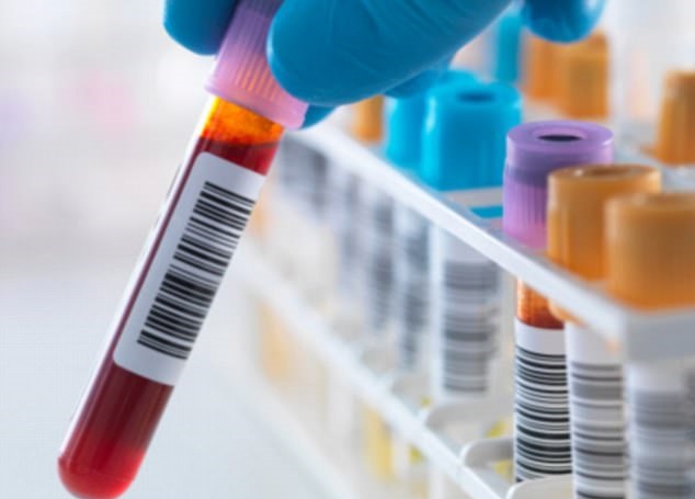 Ca nhiễm HIV được chữa khỏi thứ 3 trên thế giới - 1 Kết quả xét nghiệm cho thấy số lượng virus HIV trong máu của bệnh nhi từ mức rất cao đã xuống còn không thể phát hiện.