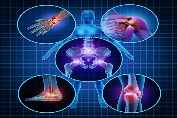 Leo cầu thang nhà nhiều lần, cô gái bị thoái hóa khớp gối - 1 Tập luyện thể thao không đúng cách khiến sụn khớp và xương dưới sụn bị tổn thương gây ra tình trạng thoái hóa khớp