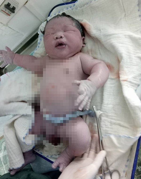 Vĩnh Phúc: Bé trai chào đời nặng kỷ lục 7,1kg - 1 Bé trai kháu khỉnh chào đời với cân nặng kỷ lục 7,1kg