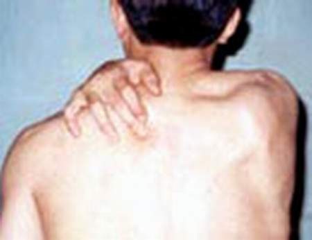 Xoa bóp phòng chống viêm họng mạn tính - 2 Huyệt phế du.