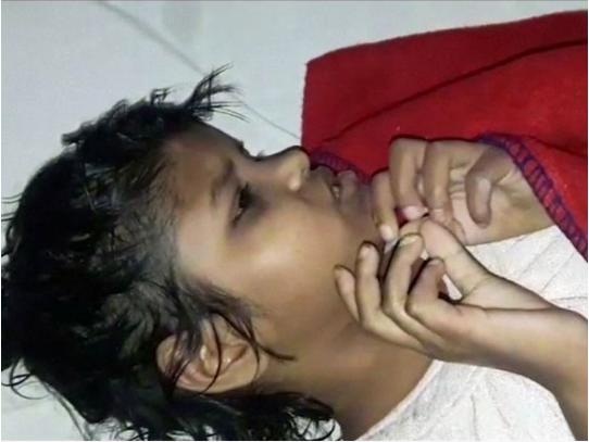 Cô bé rừng xanh sống cùng bầy khỉ ở Ấn Độ - 1 Cô bé rừng xanh được gọi là Mowgli girl vì có nhiều điểm tương đồng với cậu bé Mowgli trong bộ phim Jungle Book