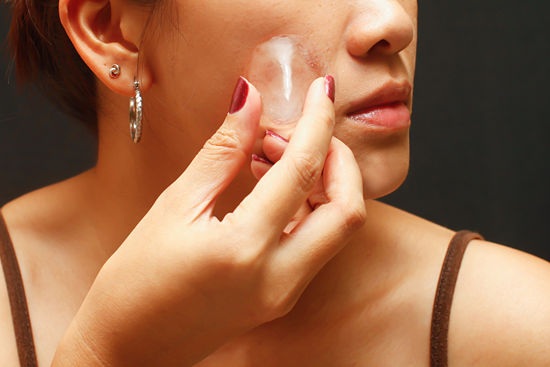 6 cách đơn giản loại bỏ vết bầm tím - 1 6 cách đơn giản loại bỏ vết bầm tím - 1