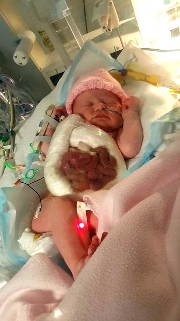 Bé sơ sinh quấn màng bọc thực phẩm vì "ruột để ngoài da" - 1 Bức ảnh được chụp chỉ vài phút sau khi Ava-Rose ra đời