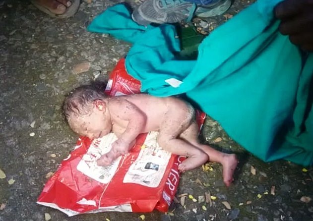 Phát hiện bé sơ sinh bị kiến bu đầy vì cha mẹ bỏ trong thùng rác - 1 Sau khi bị vứt bỏ trong thùng rác, cô bé bị kiến tấn công