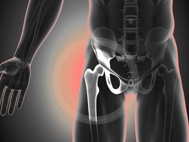 4 cảnh báo động mạch có nguy cơ tắc nghẽn - 1