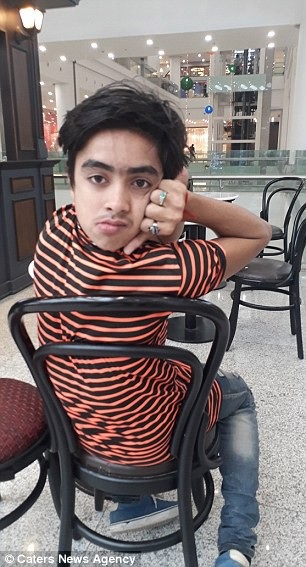 Kinh dị cậu bé có thể vặn ngược đầu ra sau lưng - 1 Muhammad có thể vặn ngược đầu 180 độ ra đằng sau