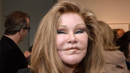 Sau khi phẫu thuật thẩm mĩ, Jocelyn Wildenstein bất ngờ được mệnh danh là “Catwoman”. Tuy nhiên, ngôi sao này không hề quyến rũ, sexy được như nhân vật Catwoman trong loạt phim “Người dơi” mà tên gọi này lại bắt nguồn từ gương mặt nửa giống người, nửa giống mèo của Wildenstein.