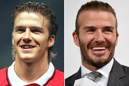 Loạt sao lớn “lột xác” nhờ sửa răng - 11 Từ xưa David Beckham đã rất điển trai nhưng để có được một nụ cười tỏa nắng như hiện tại, chàng cựu danh thủ vẫn cần tìm đến các bác sĩ nha khoa