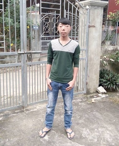 Hành trình 8 năm tìm lại cuộc đời của cậu bé 'không có mặt' - 12 Hành trình tìm lại khuôn mặt đã trải qua nhiều khó khăn của Tuấn đã “cán đích” với phần thưởng vô giá dành cho cậu bé dũng cảm – giờ đã là một thanh niên chững chạc, tự tin với bao dự định cuộc sống. Chia tay GS Mc Kinnon và các bác sĩ Vinmec, Tuấn rất cảm động, em mong muốn GS sẽ tiếp tục trở lại Việt Nam và đồng hành cùng các bác sĩ Vinmec, cùng Quỹ Thiện Tâm chữa trị được cho những người không may mắc bệnh hiểm nghèo được thành công như trường hợp của em.