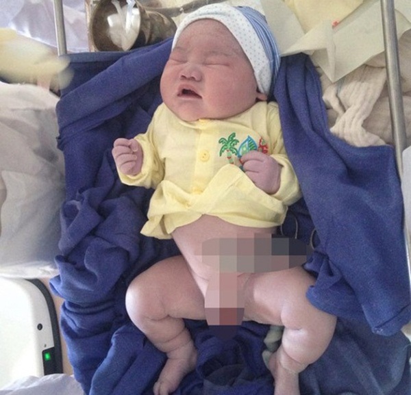 Kinh ngạc trước những em bé vừa chào đời đã có cân nặng “khủng” nhất Việt Nam - 5 Bé trai ở Nam Định với cân nặng 6,1kg