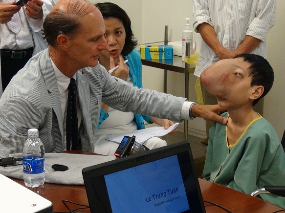 Hành trình 8 năm tìm lại cuộc đời của cậu bé 'không có mặt' - 2 “Bàn tay vàng” về tạo hình người Mỹ - GS Mc Kinnon đã hội chẩn cùng với các bác sĩ Vinmec và nhận lời phẫu thuật cho Tuấn.