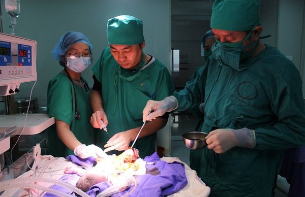 Bé gái vừa chào đời lộ nội tạng ra ngoài - 2
Ca phẫu thuật hoàn tất sau hơn 2 giờ, hiện bé đang được theo dõi đặc biệt