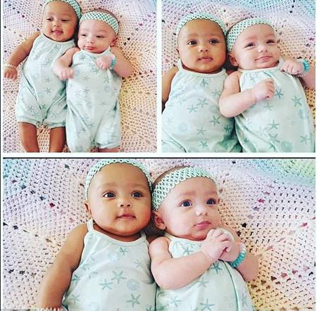 Cặp song sinh khác màu da đón sinh nhật đầu tiên - 2 Dù là sinh đôi nhưng hai cô bé sở hữu vẻ ngoài vô cùng khác biệt