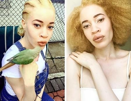 Những chân dài phá vỡ mọi giới hạn trên sàn catwalk - 2 Từng bị bắt nạt vì căn bệnh bạch tạng bẩm sinh, chính bản thân Diandra Forrest cũng không ngờ được rằng số phận mình sẽ thay đổi hoàn toàn khi vô tình lọt vào “mắt xanh” của nhiếp ảnh gia lừng danh Shameer Khan trong một lần đi dạo trên đường phố. Không chỉ trở thành siêu mẫu bạch tạng đầu tiên của Mỹ, Diandra Forrest còn là biểu tượng của những tấm gương đầy nghị lực có thể hô biến yếu điểm thành ưu điểm.