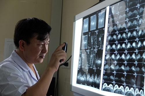 Tin “phép màu” đắp lá, bệnh nhân ung thư thêm nỗi đau - 1 TS Lê Hồng Quang khám (xem phim) để tìm phương án điều trị tốt nhất cho bệnh nhân. Ảnh: Diệu Linh