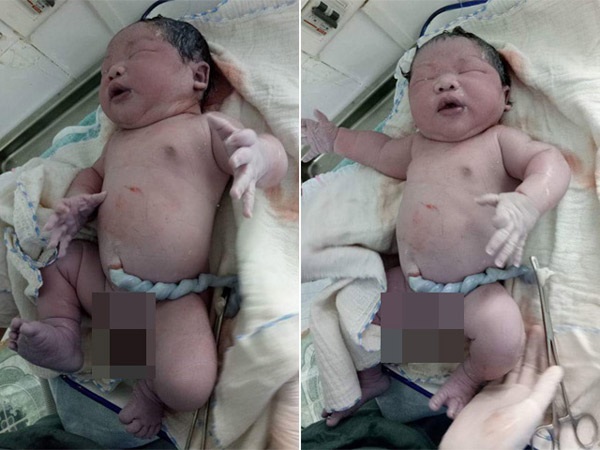 Kinh ngạc trước những em bé vừa chào đời đã có cân nặng “khủng” nhất Việt Nam - 1 Bé trai ở Vĩnh Phúc đang giữ kỷ lục vừa sinh ra đã có cân nặng lớn nhất 7,1kg