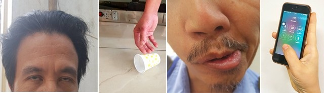 5 cách sơ cứu người tiểu đường bị đột quỵ tại nhà - 2 Cần gọi cấp cứu ngay khi người tiểu đường có dấu hiệu đột quỵ