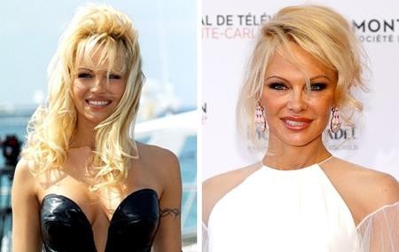 “Vỡ mộng” với hình ảnh xuống sắc của loạt sao đình đám - 2 “Quả bom sex” Pamela Anderson đã có những dấu hiệu tuổi tác vô cùng rõ ràng trên khuôn mặt. Người đẹp này cũng từng muốn níu kéo tuổi xuân bằng việc tìm tới dao kéo nhưng rõ ràng, chẳng ai có thể mãi sexy, quyến rũ như thời con gái.