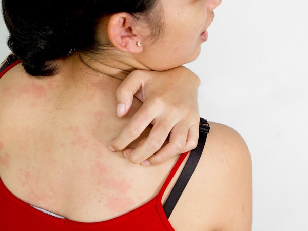 Lợi ích sức khỏe của quả na - 3 Lợi ích sức khỏe của quả na - 3