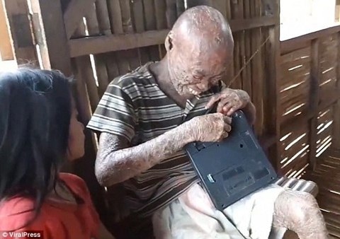 Sự thật về căn bệnh lạ khiến người đàn ông bị xua như đuổi tà - 4 Antonio mong muốn được chữa khỏi bệnh để trở thành một thợ điện như mơ ước