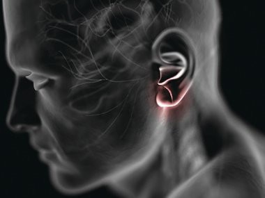 4 cảnh báo động mạch có nguy cơ tắc nghẽn - 3