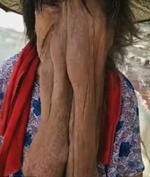 Cuộc đời bi thảm của góa phụ có biệt danh “bà voi” - 4 Dù mang vẻ ngoài đáng sợ, bà cũng từng có hai đời chồng