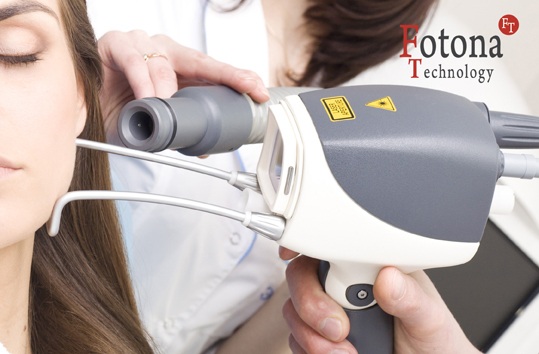 FOTONA 4D- sự lựa chọn hoàn hảo trong điều trị nâng cơ, trẻ hóa khuôn mặt - 4