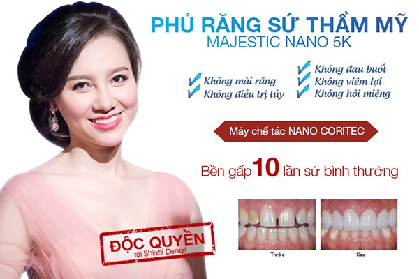 Hành trình sắc đẹp không giống ai của MC Minh Hà - 4 Công nghệ cũ làm răng sứ đang sử dụng rộng rãi tại Việt Nam, thế giới đã loại bỏ từ 10 năm trước. Mài răng, bọc răng sứ có khung sườn kim loại bên trong là cách làm đã cũ, gây tổn hại răng gốc. Hành trình lại nụ cười của MC Minh Hà tại Viện Công nghệ Nha khoa thẩm mỹ Shinbi, địa chỉ 33 Trần Quốc Toản, Hà Nội, mở ra cơ hội làm đẹp thông thái cho không ít người. Shinbi sử dụng máy cắt siêu âm Untrasonic và máy chế tác Nano Coritec tạo ra miếng dán sứ siêu mỏng 0,15mm-0,2mm giúp bảo tồn 100% răng gốc. Công nghệ Majestic Nano 5k là giải pháp an toàn, hiệu quả và giải quyết triệt để những hạn chế của phương pháp bọc răng sứ cũ. Sau 24h phủ răng sứ tại Shinbi Dental, Minh Hà đã thật sự tìm lại nụ cười duyên dáng.