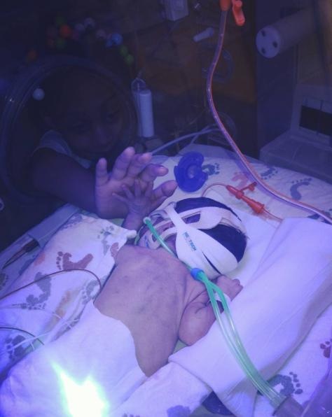 Bé đã phải sống trong lồng kính một thời gian