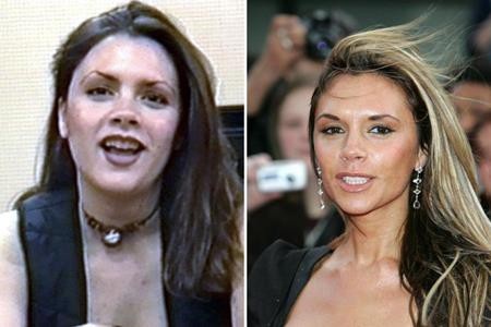 Loạt sao lớn “lột xác” nhờ sửa răng - 4 Victoria Beckham thường ít cười vì không tự tin về hàm răng của mình và các fans hâm mộ cũng tán thành với quyết định làm răng của cựu sao Spice girls