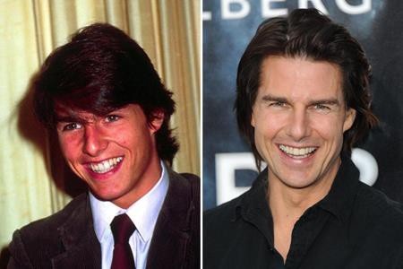 Loạt sao lớn “lột xác” nhờ sửa răng - 6 Tom Cruise chính là ngôi sao hạng A minh chứng cho câu “thay răng đổi vận”