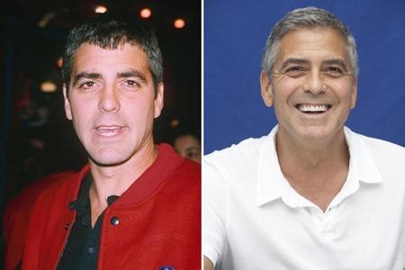 Loạt sao lớn “lột xác” nhờ sửa răng - 9 Để có được hàm răng đều tăm tắp như hiện tại, George Clooney đã phải đi làm răng hồi năm 2008