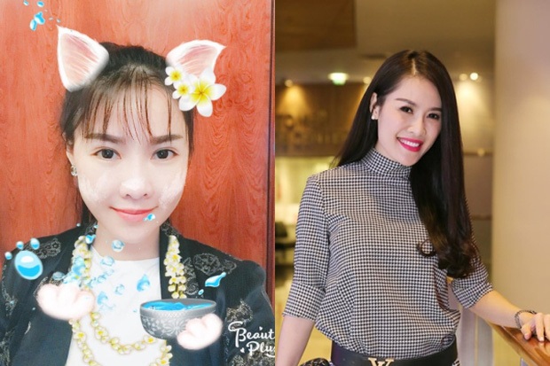 Điều gì khiến sao Việt đua nhau “đập mặt xây lại”? - 8
Quế Vân là trường hợp tự tin đăng tải hình ảnh quá trình phẫu thuật thẩm mỹ lên trang cá nhân và không quên “khoe” mình đã chi nửa tỷ đồng sang xứ sở Kim Chi để tiến hành 6 bước thẩm mỹ với quan điểm “Đẹp phải khoe, xấu mới che, làm là nhận…”. Lý do dao kéo được Quế Vân công khai chia sẻ trên trang cá nhân rằng: “Phụ nữ là phải đẹp, không sẽ rất thiệt thòi. Vậy nên tui sẽ không để thiệt thòi nữa”.