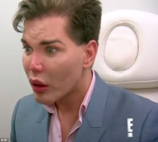 Mũi của "búp bê sống" Rodrigo Alves có thể rơi ra - 3
Mới đây Rodrigo Alves đã rất lo lắng sau khi bác sỹ nói mũi anh có thể rơi ra vì đụng chạm dao kéo quá nhiều trong 1 thời gian ngắn