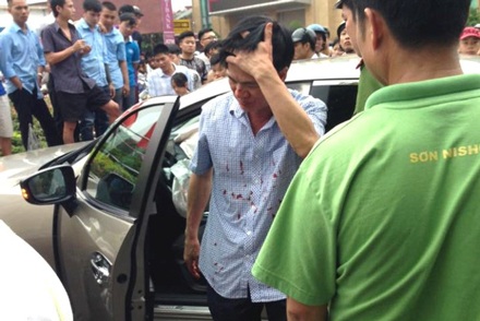 Vụ ô tô gây tai nạn liên hoàn: Người cầm lái là Viện trưởng VKSND huyện - 1
Ông Đặng Việt Khoa bước xuống xe ô tô sau khi gây ra vụ tai nạn liên hoàn trong tình trạng có vết thương ở đầu. (Ảnh: Tùng B.).