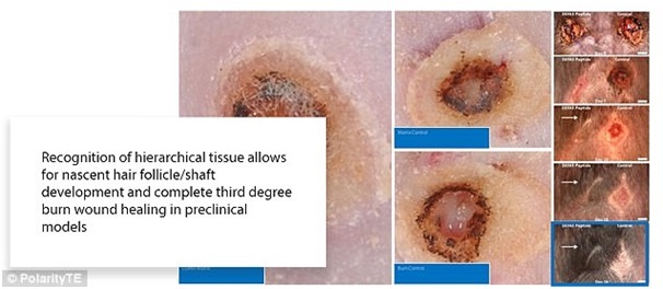 
Vì da lợn phức tạp và có nhiều sức mạnh hơn da người nên những dữ liệu thu được từ việc thí nghiệm thành công trên da lợn, được xem như là tiền đề cho các thử nghiệm hiệu quả trên con người.
