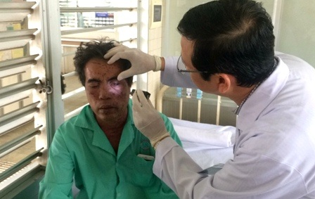 Vụ người đàn ông tạt cả can a xít: Mâu thuẫn âm ỉ từ chiếc xe chở cơm thiu - 1 Ít nhất 3 người trong vụ việc có nguy cơ bị ảnh hưởng đến thị lực