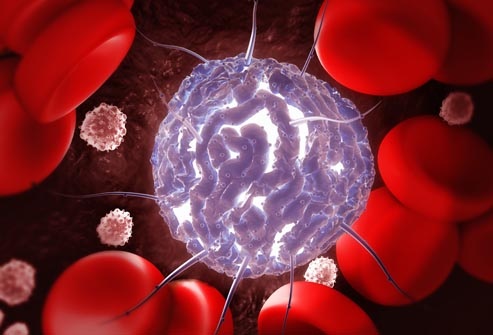 Những điều cần biết về ghép tế bào gốc điều trị ung thư máu - 1