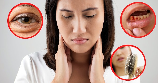 5 triệu chứng thiếu vitamin biểu hiện rõ trên khuôn mặt - 1 5 triệu chứng thiếu vitamin biểu hiện rõ trên khuôn mặt - 1