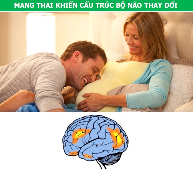 Những thói quen hàng ngày tác động thế nào đến bộ não của chúng ta - 4 Những thói quen hàng ngày tác động thế nào đến bộ não của chúng ta - 4