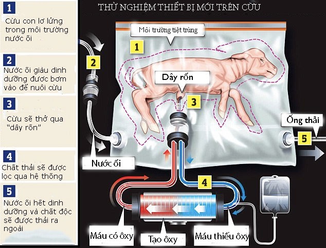Sẽ có những em bé chào đời từ "túi nhựa"? - 1 Sẽ có những em bé chào đời từ "túi nhựa"? - 1